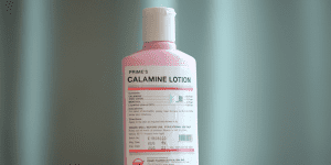 . Keep a Calamine Lotion Handy 