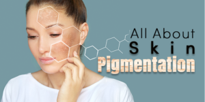All About Skin Pigmentation