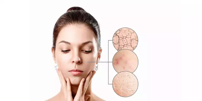 Homeopathic Treatments For Skin Pigmentation