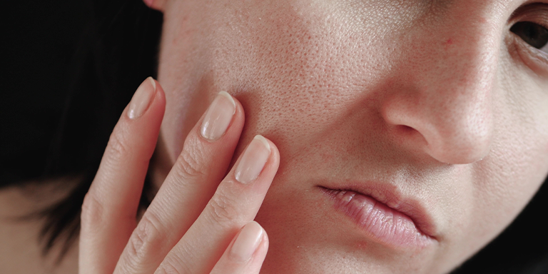 Helps Tighten Skin Pores